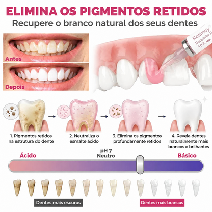 🇵🇹 Bremvik®🎐🎐 DenPerm Gel Natural Reparador de Cáries e Restaurador do Esmalte Dentário