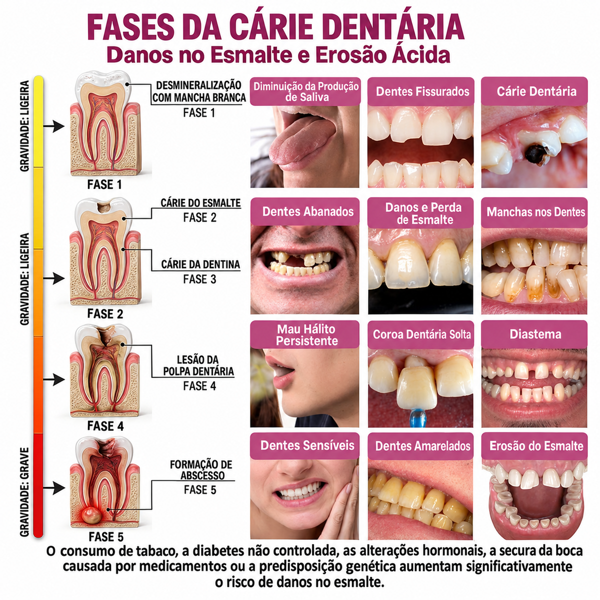 🇵🇹 Bremvik®🎐🎐 DenPerm Gel Natural Reparador de Cáries e Restaurador do Esmalte Dentário