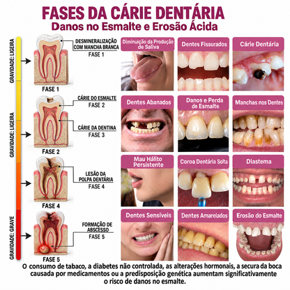 🇵🇹 Bremvik®🎐🎐 DenPerm Gel Natural Reparador de Cáries e Restaurador do Esmalte Dentário
