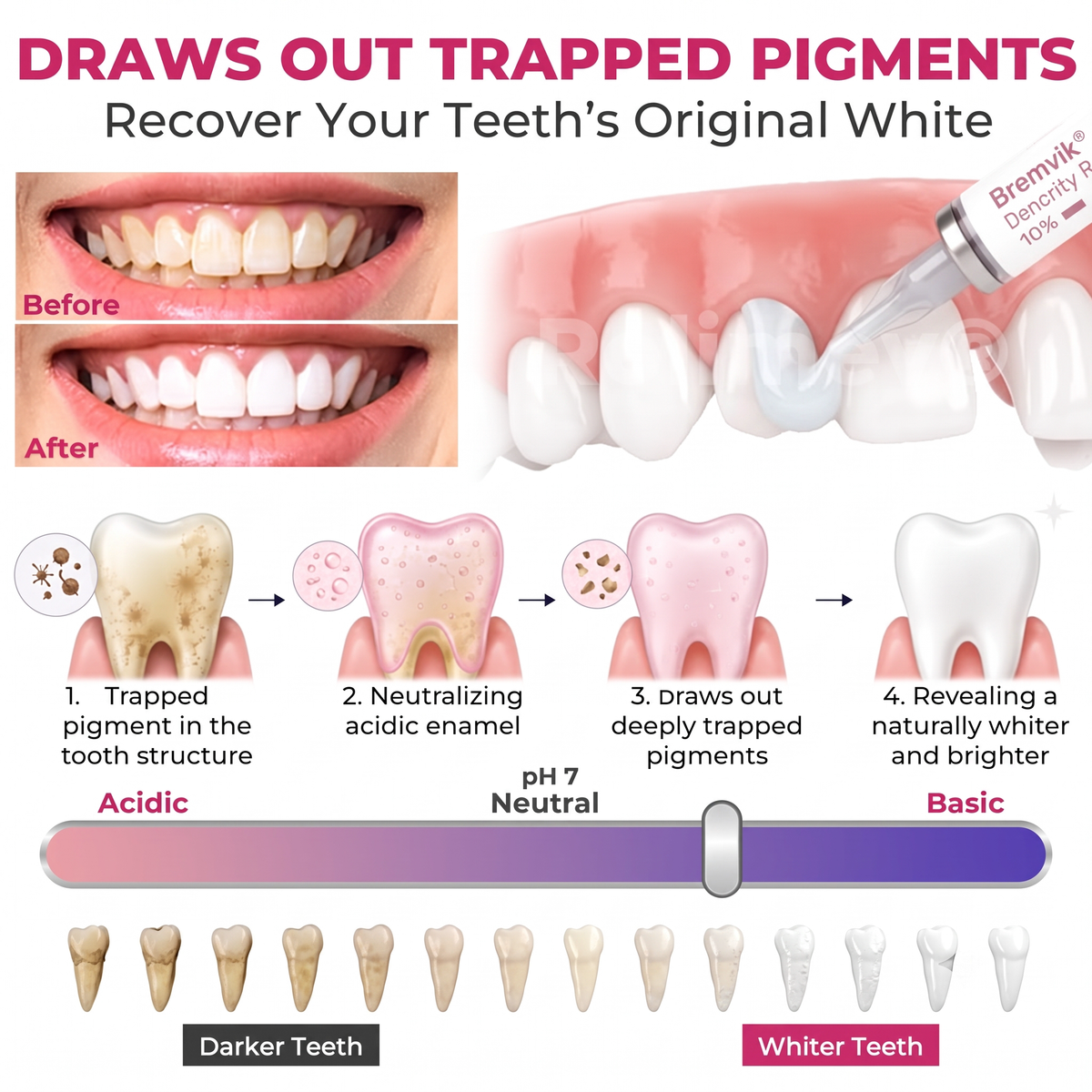 🇺🇸Bremvik® DenPerm Cavity-Repair Natural Enamel Filling Gel